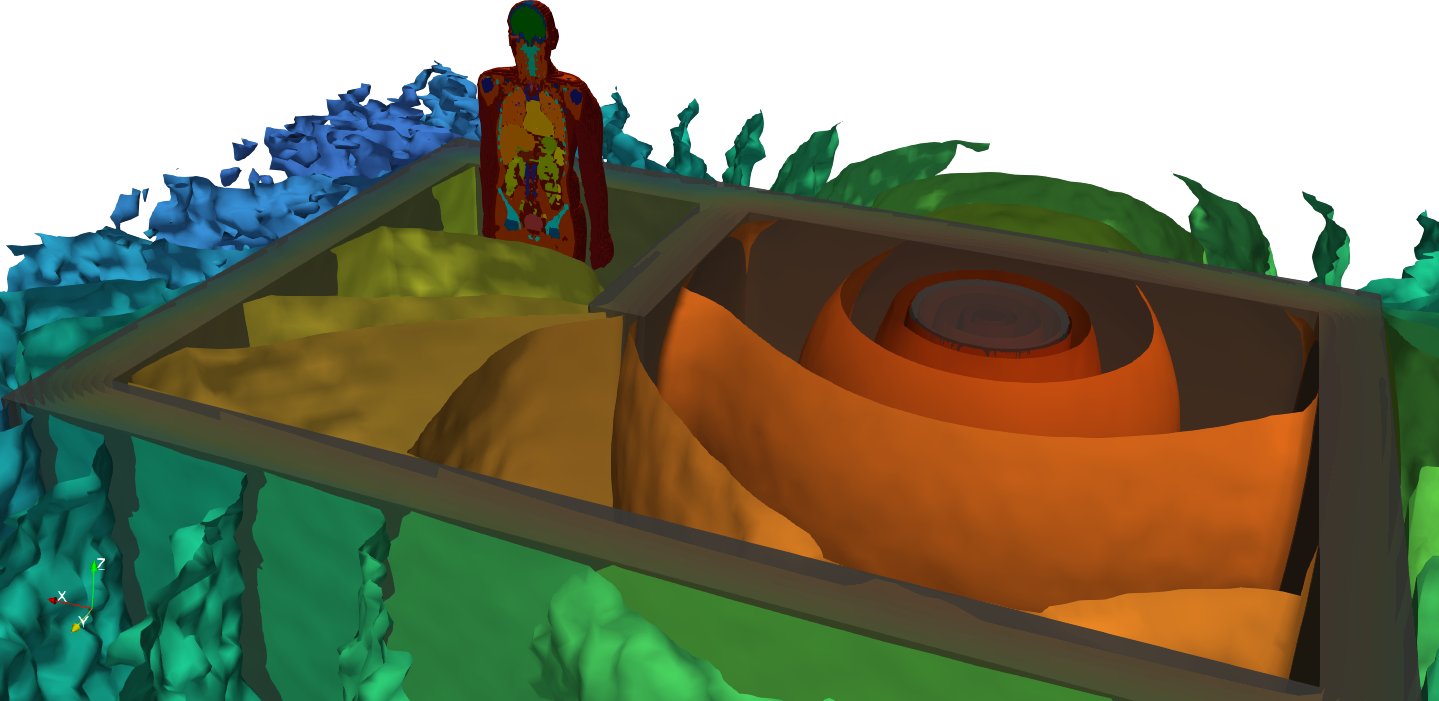 Voxel human phantom beside a shielded source with 3D neutron dose distribution (Monte Carlo)